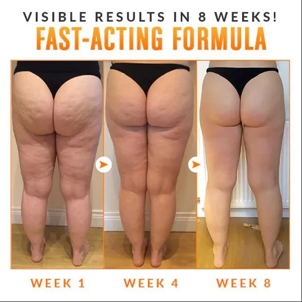 BEAUTIFIC Anti-Cellulite Firming Soap